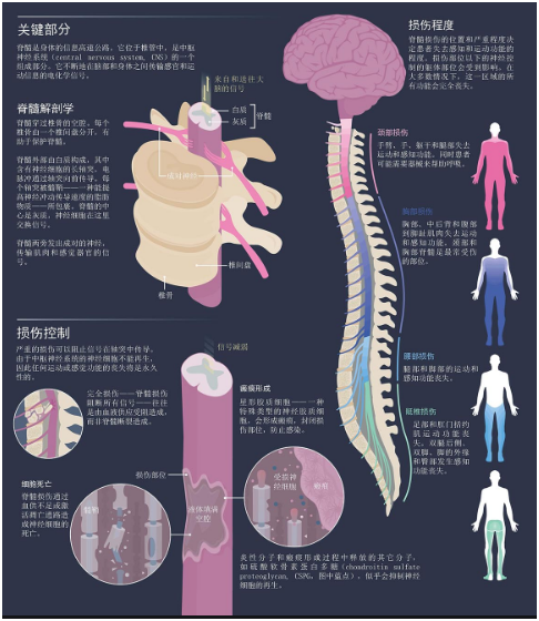 脊髓损伤研究的最新进展与突破