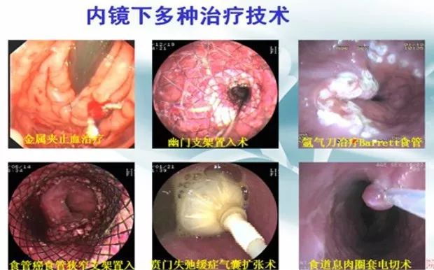 最新胃肠镜医生招聘，专业人才迫切需求呼唤有志之士加盟